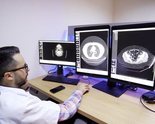 Teleradiologia: Soluția inovatoare pentru interpretarea rezultatelor RMN și CT